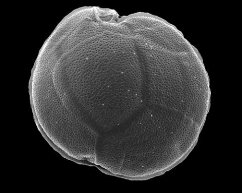 Gambierdiscus micro-algae produce toxins that can accumulate in higher apex tropical reef predator species. Photo: UTS